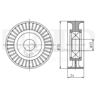 Ролик натяжной приводного ремня UNIO TNS-10277 1441317275 OSQ6 ZA - Изображение 3